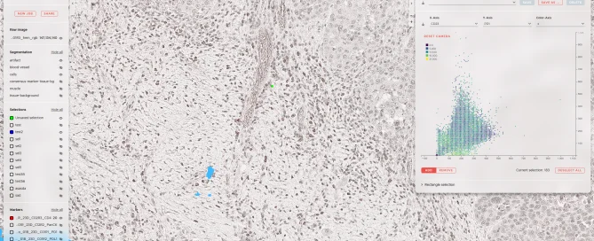 Microscopic image of tissue with a scatter plot, overlaid data fields, and medical technology software.