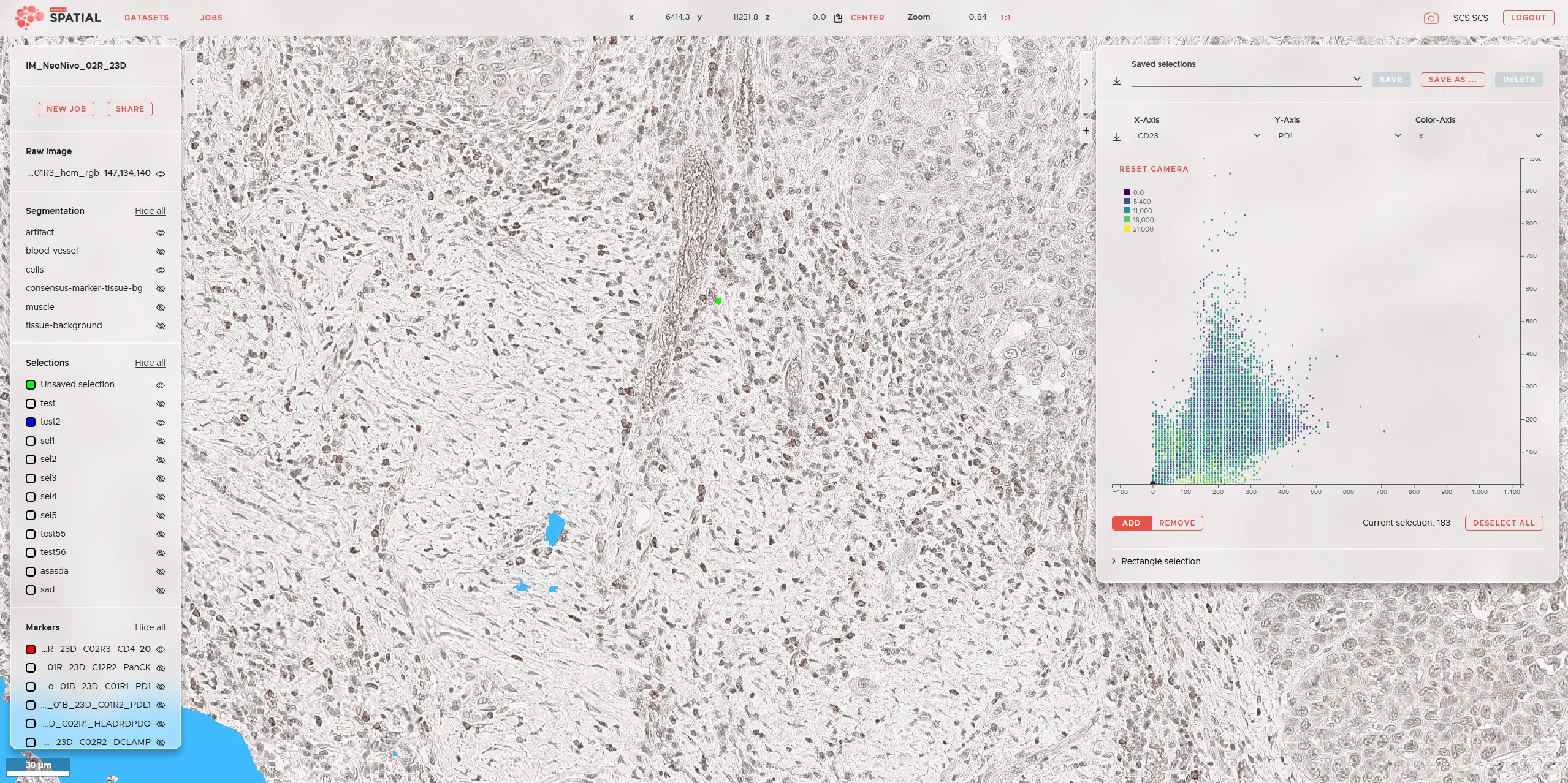 Microscopic image of tissue with a scatter plot, overlaid data fields, and medical technology software. Microscopic image of tissue with a scatter plot, overlaid data fields, and medical technology software.